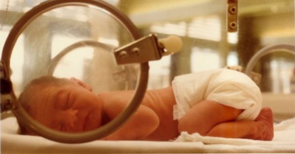 Was sind die Ursachen für neonatale Gelbsucht und wie ist die Behandlung?