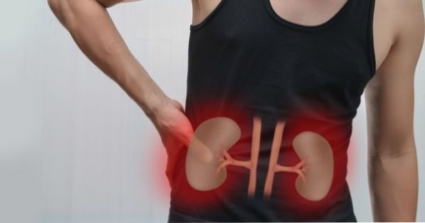 What are the symptoms for kidney stones?