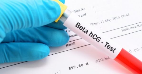 Resultado del examen de embarazo - Beta-HCG